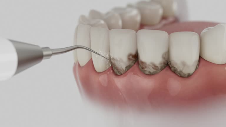 Trusted Dental Implants service in Morrow, GA - Dentist Open Now